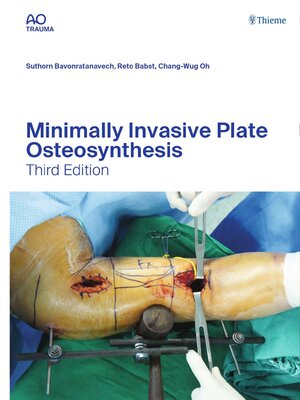 cover image of Minimally Invasive Plate Osteosynthesis